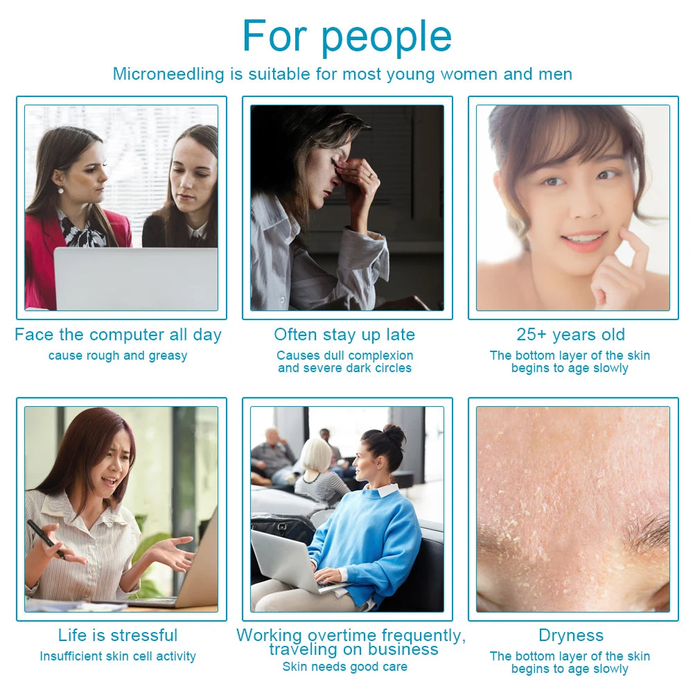 540 Needles Derma Roller